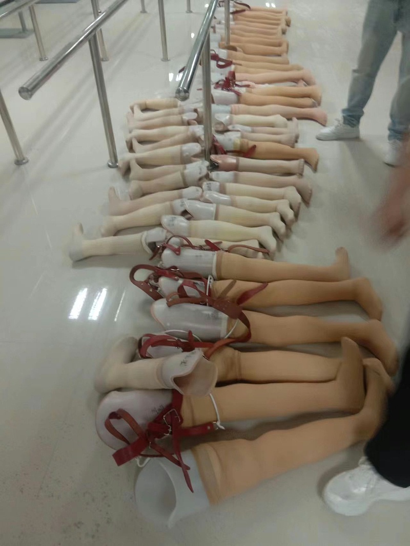 助力残疾人美好生活丨张家口市残联携手恩德莱开展假肢救助项目