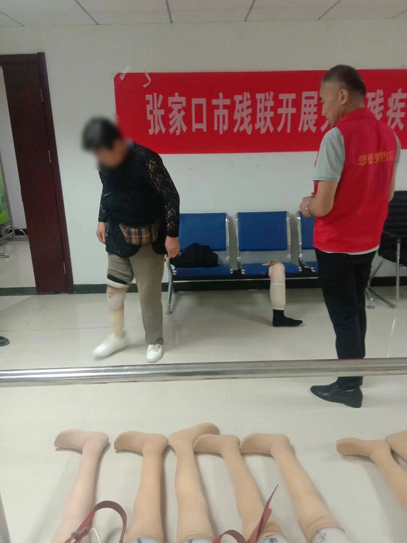 助力残疾人美好生活丨张家口市残联携手恩德莱开展假肢救助项目