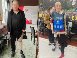 精工筑支撑，专业守希望——恩德莱太原爱心店技术部康复纪实