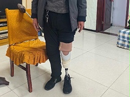 恩德莱太原爱心店上门适配假肢，将专业与温暖送到家